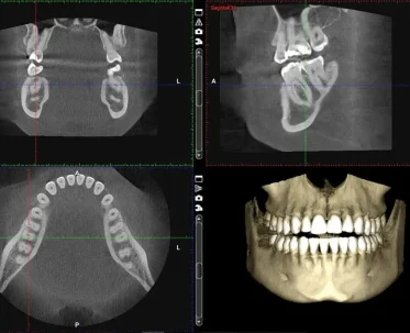 cbct1